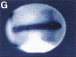 Xenbase Expression Image Xenbase Expression Image