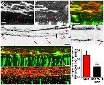 Xenbase Expression Image Xenbase Expression Image