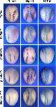 Xenbase Expression Image Xenbase Expression Image