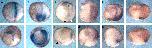 Expression Image Expression Image