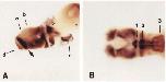 Xenbase Expression Image Xenbase Expression Image