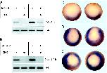 Expression Image