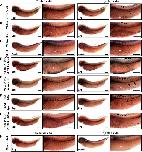 Expression Image