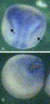 Expression Image