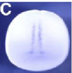 Expression Image