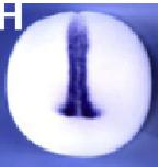 Expression Image