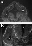Expression Image