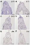 Expression Image