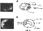 Expression Image