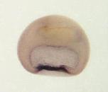 Expression Image
