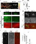 Expression Image