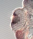 Expression Image