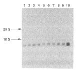 Expression Image