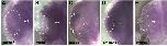 Expression Image