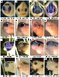 Expression Image