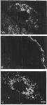 Expression Image
