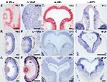 Expression Image
